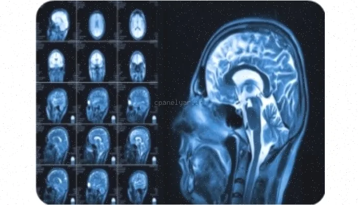 اسکن MRI: راهنمای کامل و جامع